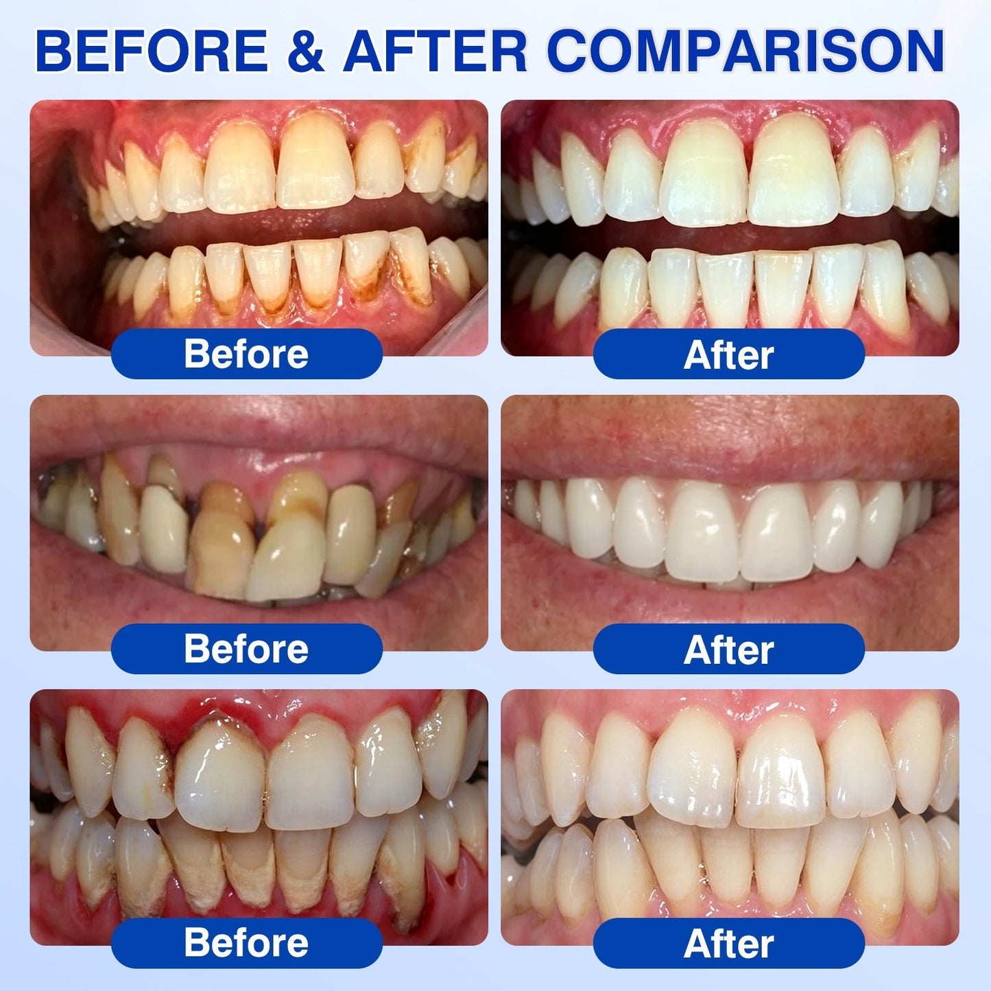 👨⚕️Haugde® GumRevive Periodontal Repair Gel🦷🛡️