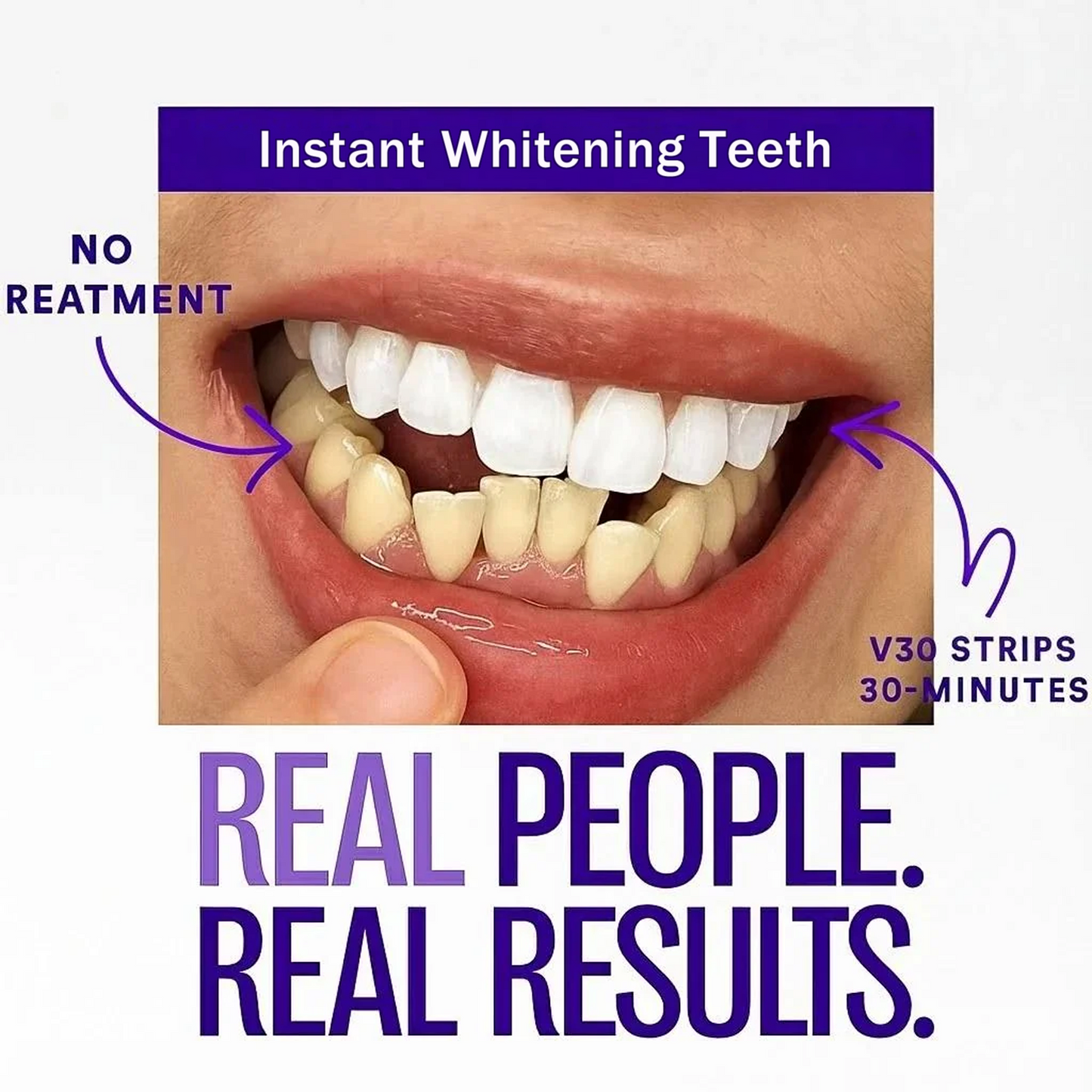 HZA Purple Teeth Whitening Strips
