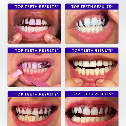 HZA Purple Teeth Whitening Strips